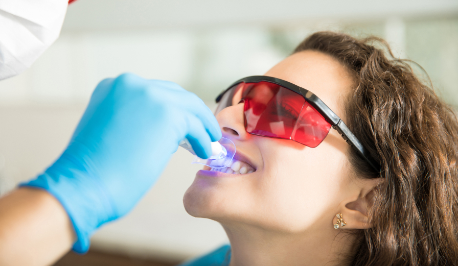 $399 At-Home Zoom Whitening Treatment