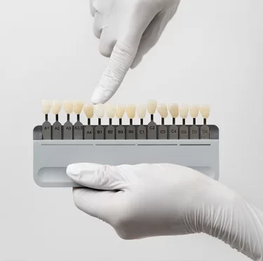 How-to-Care-for-Your-Veneers-and-Keep-Them-Looking-New
